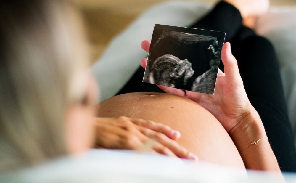 Porođajna doula